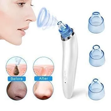 4 In 1 Multi-Function Blackhead And Whitehead Remover Vacuum Suction