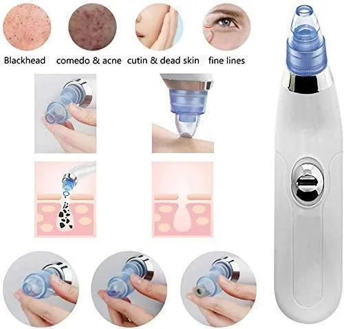 4 In 1 Multi-Function Blackhead And Whitehead Remover Vacuum Suction